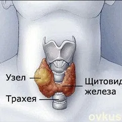 Как привести в порядок щитовидку