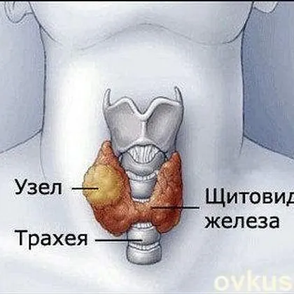 Как привести в порядок щитовидку